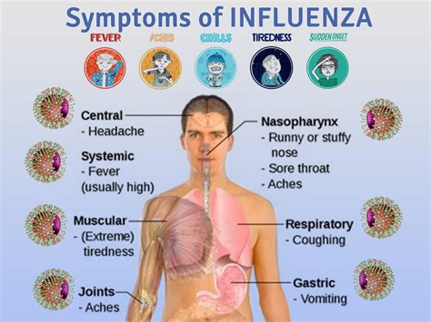 symptoms of the flu 2015